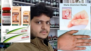 homeopathic medicine for warts removal on face neck finger feet explain [upl. by Ddart]