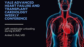 Left ventricular unloading during ECMO [upl. by Latty]