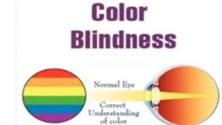 colour blindnessY linked traits [upl. by Saideman921]