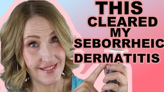 HOW I CLEARED UP MY SEBORRHEIC DERMATITIS [upl. by Milburr537]