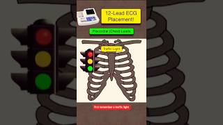 12 Lead ECG placement ECG leads kaise lagay ecg biology shorts youtubeshorts youtube [upl. by Ramsey]