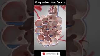 Congestive Heart Failure Explain 3DAnimation shorts [upl. by Yretsym]