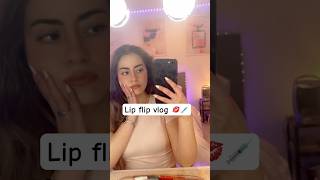 Lip flip botox injections mini vlog and results [upl. by Ecidnac]