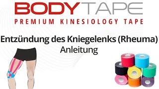 Kinesiology Tape Anleitung Entzündung des Kniegelenks Rheuma [upl. by Wildee]