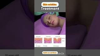 skin wrinkles treatment at home asmr ramdy for wrinkle [upl. by Eehsar]