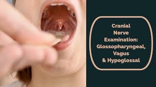 Cranial Nerve Examination CN 9 10 amp 12 glossopharyngeal vagus amp hypoglossal [upl. by Ahsenav]