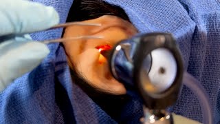 ASMR Removing a Foreign Object from Your Ear  Doctor amp Patient POV  Hearing Test [upl. by Stuppy797]