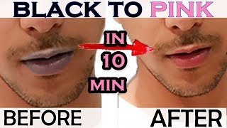 HOW TO GET RID OF DARK LIPS BLACK LIPS AT HOME WITH EASY METHOD   GET BABY SOFT PINK LIPS [upl. by Aldus]