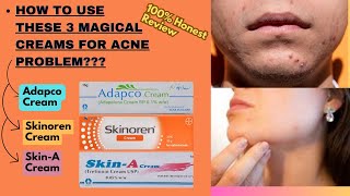 How To Use Adapco Skinoren and Skin A Cream  How To Apply Adapco Skin A and Skinoren Cream [upl. by Bosch]