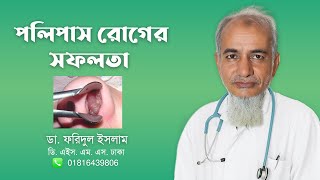 নাকের পলিপাসের হোমিও চিকিৎসা  Dr Faridul Islam [upl. by Elinnet]