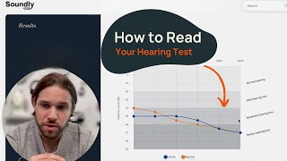 How to Read a Hearing Test  Common Configurations [upl. by Enelloc]