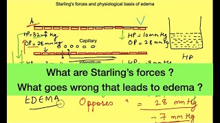 Starling forces hydrostatic pressure vs oncotic pressure  Pathophysiology of Edema [upl. by Mirna600]