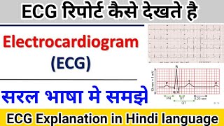 ECG report कैसे देखते है  Electrocardiogram explanation in hindi language [upl. by Webber]