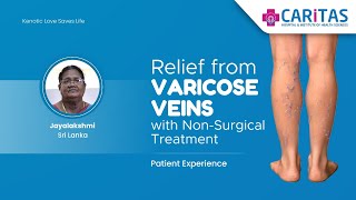 Relief from Varicose Veins with NonSurgical Treatment patienttestimonial srilanka [upl. by Merline338]