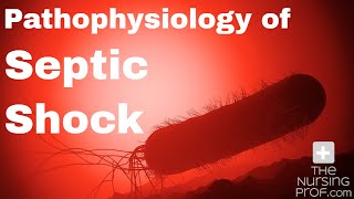 Pathophysiology of Septic Shock [upl. by Couq]