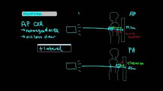 Types of Chest XRays part 1  AP vs PA UndergroundMed [upl. by Manouch358]