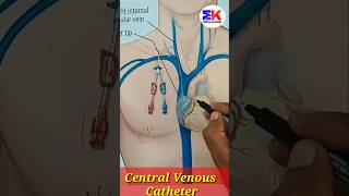 central venous catheter medicineknowledgehindi biology shorts [upl. by Jairia]