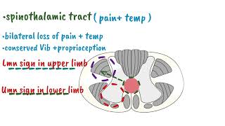 Syringomyelia  Spinal Cord Lesion [upl. by Shanie455]