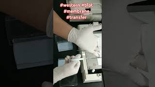 western blot membrane transfer [upl. by Edyaj]