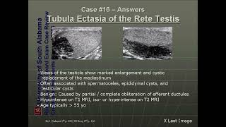 ultrasound radiologysonology [upl. by Swanhilda]