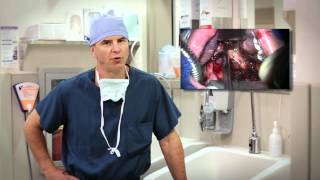 Transoral Surgery for Head and Neck Cancer  Mayo Clinic [upl. by Nairb]