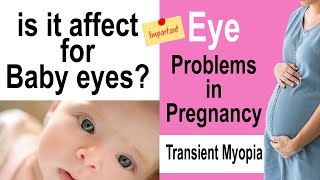 Why Need to check eye vision in pregnancy  is it affect for baby watch carfully [upl. by Htinnek169]