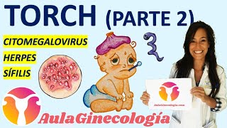 TORCH PARTE 2 CITOMEGALOVIRUS HERPES SÍFILIS Infecciones y embarazo Ginecología y Obstetricia [upl. by Eyot]