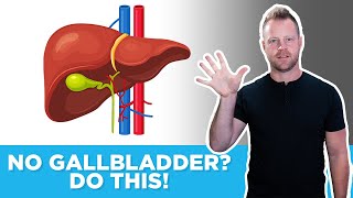 5 Things You Must Do If You Have No Gallbladder [upl. by Haneeja]