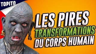 Top 5 des pires transformations du corps humain oui cest moche [upl. by Gower]