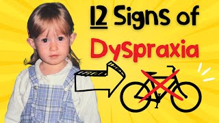 Could you actually have Dyspraxia DCD [upl. by Ssew]