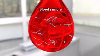 CRISPRCas13a powered electrochemical microfluidic biosensor for nucleic acid miRNA diagnostics [upl. by Maridel519]