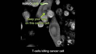 Labelfree Live Cell Imaging Tcells killing cancer cells [upl. by Ynnot]