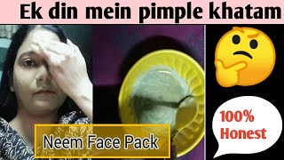 Ek Din Mein Pimple Khatam  Neem Face Pack ARMBeautyHacks [upl. by Otrebliw]