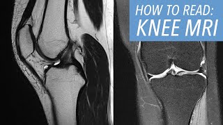 How to Read an MRI of the Knee An Introductory Approach [upl. by Cire]