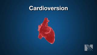 Cardioversion Procedure Returning a heartbeat to normal rythm [upl. by Bradshaw]