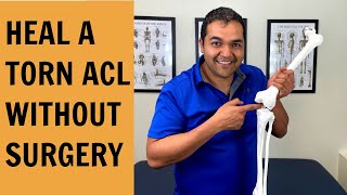 How To Test amp Heal A Torn ACL Without Surgery [upl. by Bushweller212]