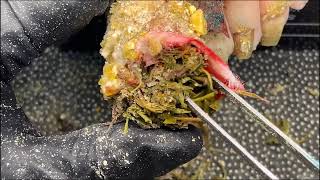 CUT Ingrown Toenails Toenails with Maggots Fungal Toenails  TREATMENT OF Ingrown Toenails N160 [upl. by Bilicki]