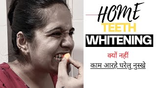 Does Baking soda whiten teeth at home  Teeth whitening at home remedy 100 workinghindi2021 [upl. by Fannie955]