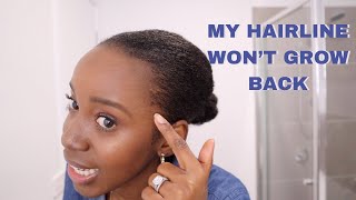 How to Maintain Healthy Edges amp Hairline on Natural Hair  4C 4B Tips amp Tricks [upl. by Ttereve]