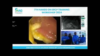 ERCP 7Th Hands on Ercp  Training Workshop 2024 [upl. by Eidlog526]