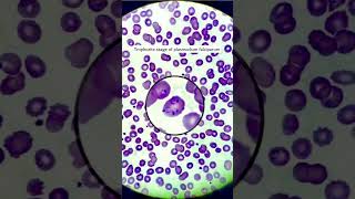 Malaria parasite under microscope trophozite of plasmodium falciparum microscopyparasitology [upl. by Franza]