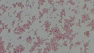 Klebsiella pneumoniae Gram stained Footages under the Microscope Gram Negative Bacteria [upl. by Andrey]