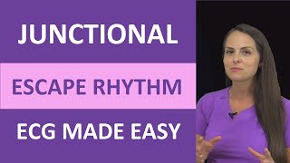 Junctional Escape Rhythm ECG Made Easy Nursing Next Generation NCLEX EKG [upl. by Oiramad439]