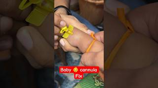 Intravenous cannula fix in baby 👶  cannula hospital trending shorts youtubeshorts [upl. by Elidad495]