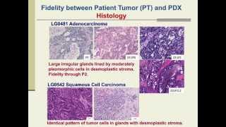 PatientDerived Xenografts for Cancer Therapeutics Development and Predictive Modeling [upl. by Henrietta]