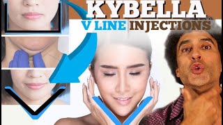 V LINE  KYBELLA [upl. by Attegroeg]