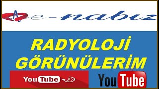 E NABIZ ÜZERİNDEN RADYOLOJİ GÖRÜNTÜLERİME NASIL ULAŞABİLİRİM ENGELSİZ TV [upl. by Barbette]