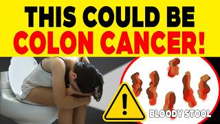 Warning Signs of Colon Cancer To Recognise Before Its Too Late [upl. by Bratton]