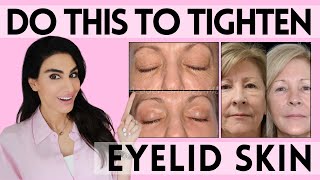 Eyelid Rejuvenation 101 Dermatologist Reveal Skin Tightening Treatments for the Eyes [upl. by Han303]