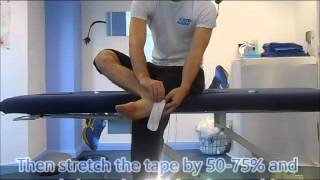 Shin Splints MTSS taping [upl. by Gregory498]